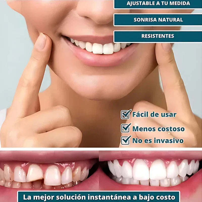 [PROMO] SmilePro 🦷 - Carillas Dentales Ajustables De Resina + ESTUCHE REGALO - ¡Últimas unidades! 🔥