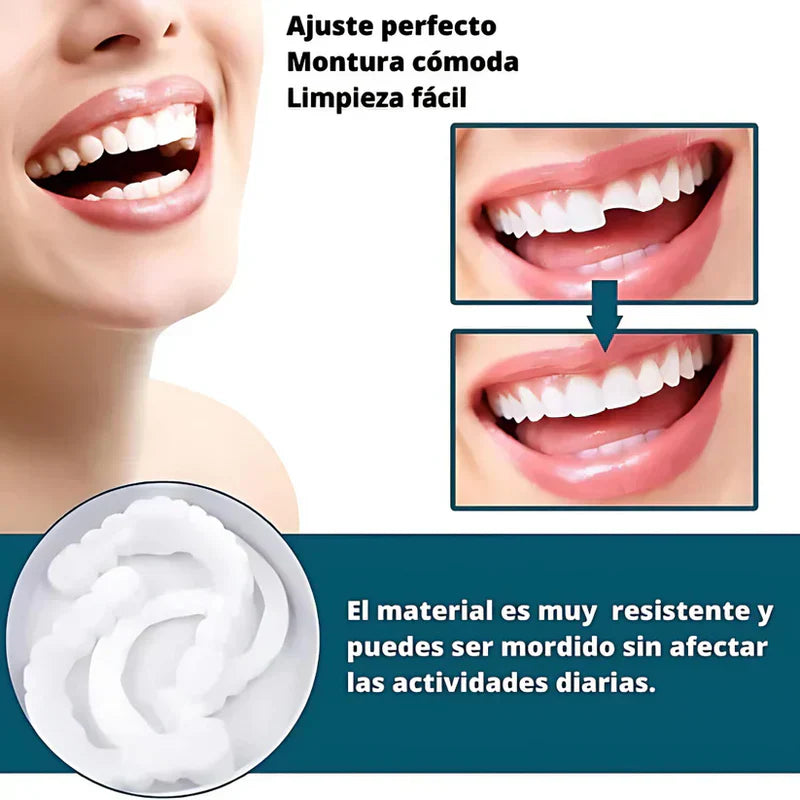 [PROMO] SmilePro 🦷 - Carillas Dentales Ajustables De Resina + ESTUCHE REGALO - ¡Últimas unidades! 🔥